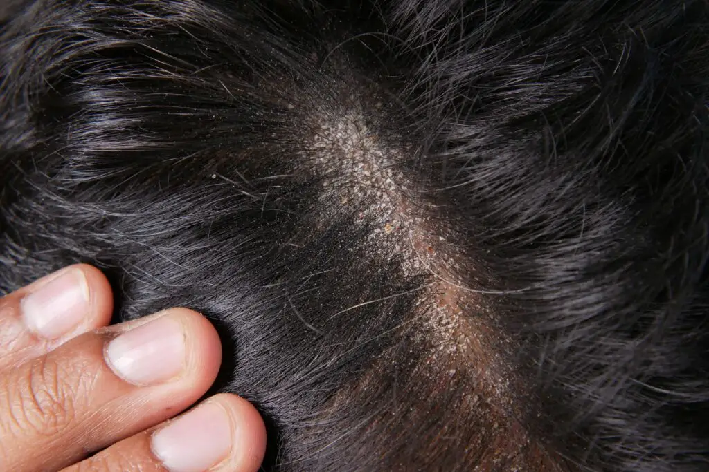 Trockenshampoo und seine Wirkung auf die Kopfhaut – organische Haarpflege bei Marco Stauber